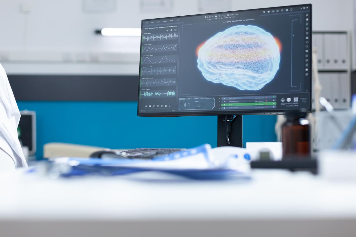 Electromiografía (EMG) en CDMX: Diagnóstico preciso en Neurofisiología Clínica
