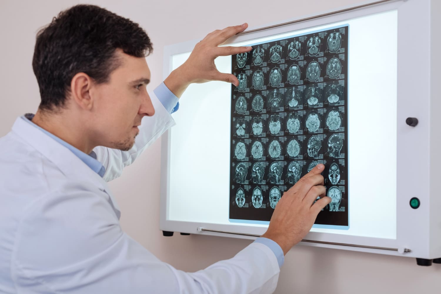 Estudios de conducción nerviosa en CDMX: diagnóstico preciso en Neurofisiología Clínica